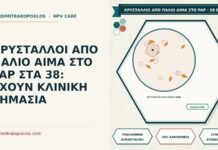 ΚΡΥΣΤΑΛΛΟΙ ΑΠΟ ΠΑΛΙΟ ΑΙΜΑ ΣΤΟ PAP ΣΤΑ 38: ΕΧΟΥΝ ΚΛΙΝΙΚΗ ΣΗΜΑΣΙΑ κρύσταλλοι από παλιό αίμα στο Παπ