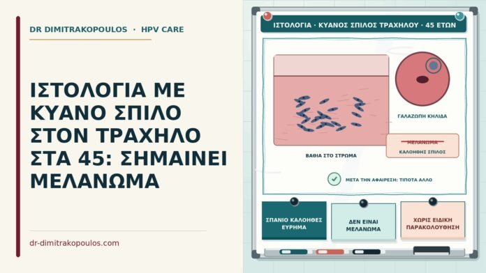 ΙΣΤΟΛΟΓΙΑ ΜΕ ΚΥΑΝΟ ΣΠΙΛΟ ΣΤΟΝ ΤΡΑΧΗΛΟ ΣΤΑ 45: ΣΗΜΑΙΝΕΙ ΜΕΛΑΝΩΜΑ κυανός σπίλος στον τράχηλο