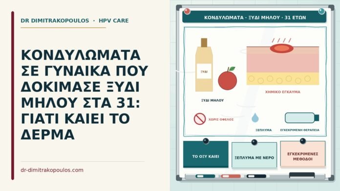 κονδυλώματα και ξύδι μήλου