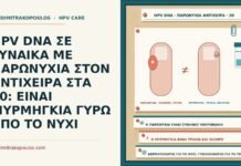 HPV DNA ΣΕ ΓΥΝΑΙΚΑ ΜΕ ΠΑΡΩΝΥΧΙΑ ΣΤΟΝ ΑΝΤΙΧΕΙΡΑ ΣΤΑ 30: ΕΙΝΑΙ ΜΥΡΜΗΓΚΙΑ ΓΥΡΩ ΑΠΟ ΤΟ ΝΥΧΙ HPV DNA με παρωνυχία