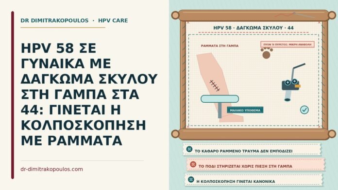 HPV 58 με δάγκωμα σκύλου