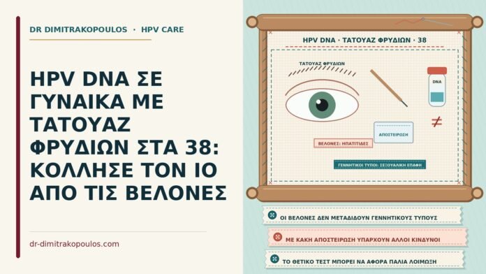 HPV DNA ΣΕ ΓΥΝΑΙΚΑ ΜΕ ΤΑΤΟΥΑΖ ΦΡΥΔΙΩΝ ΣΤΑ 38: ΚΟΛΛΗΣΕ ΤΟΝ ΙΟ ΑΠΟ ΤΙΣ ΒΕΛΟΝΕΣ HPV DNA με τατουάζ φρυδιών