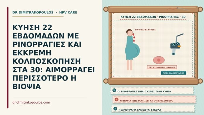 ΚΥΗΣΗ 22 ΕΒΔΟΜΑΔΩΝ ΜΕ ΡΙΝΟΡΡΑΓΙΕΣ ΚΑΙ ΕΚΚΡΕΜΗ ΚΟΛΠΟΣΚΟΠΗΣΗ ΣΤΑ 30: ΑΙΜΟΡΡΑΓΕΙ ΠΕΡΙΣΣΟΤΕΡΟ Η ΒΙΟΨΙΑ κύηση με ρινορραγίες και κολποσκόπηση