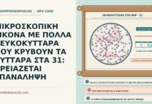 λευκοκύτταρα που κρύβουν τα κύτταρα