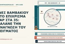 ΙΝΕΣ ΒΑΜΒΑΚΙΟΥ ΣΤΟ ΕΠΙΧΡΙΣΜΑ PAP ΣΤΑ 35: ΧΑΛΑΝΕ ΤΗΝ ΑΝΑΓΝΩΣΗ ΤΟΥ ΔΕΙΓΜΑΤΟΣ ίνες βαμβακιού στο επίχρισμα Παπ