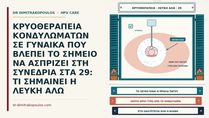 λευκή άλω στην κρυοθεραπεία
