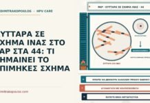 ΚΥΤΤΑΡΑ ΣΕ ΣΧΗΜΑ ΙΝΑΣ ΣΤΟ PAP ΣΤΑ 44: ΤΙ ΣΗΜΑΙΝΕΙ ΤΟ ΕΠΙΜΗΚΕΣ ΣΧΗΜΑ κύτταρα σε σχήμα ίνας στο Παπ