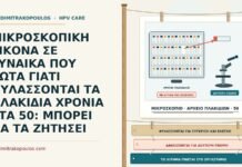 ΜΙΚΡΟΣΚΟΠΙΚΗ ΕΙΚΟΝΑ ΣΕ ΓΥΝΑΙΚΑ ΠΟΥ ΡΩΤΑ ΓΙΑΤΙ ΦΥΛΑΣΣΟΝΤΑΙ ΤΑ ΠΛΑΚΙΔΙΑ ΧΡΟΝΙΑ ΣΤΑ 50: ΜΠΟΡΕΙ ΝΑ ΤΑ ΖΗΤΗΣΕΙ αρχείο πλακιδίων κυτταρολογίας