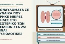 ΚΟΝΔΥΛΩΜΑΤΑ ΣΕ ΓΥΝΑΙΚΑ ΠΟΥ ΒΡΗΚΕ ΜΙΚΡΕΣ ΘΗΛΕΣ ΣΤΟ ΕΣΩΤΕΡΙΚΟ ΤΩΝ ΧΕΙΛΕΩΝ ΣΤΑ 25: ΕΙΝΑΙ ΦΥΣΙΟΛΟΓΙΚΕΣ θηλές του προδόμου και κονδυλώματα