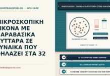 ΜΙΚΡΟΣΚΟΠΙΚΗ ΕΙΚΟΝΑ ΜΕ ΠΑΡΑΒΑΣΙΚΑ ΚΥΤΤΑΡΑ ΣΕ ΓΥΝΑΙΚΑ ΠΟΥ ΘΗΛΑΖΕΙ ΣΤΑ 32 παραβασικά κύτταρα στον θηλασμό