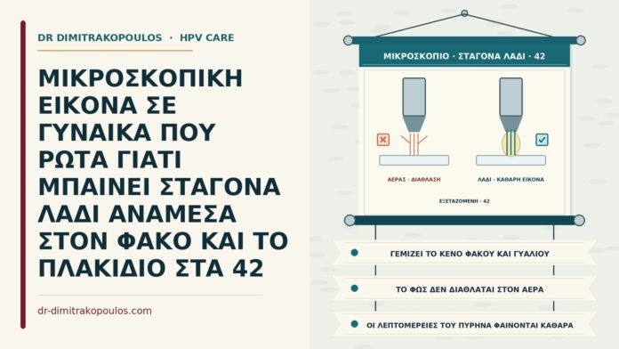 ΜΙΚΡΟΣΚΟΠΙΚΗ ΕΙΚΟΝΑ ΣΕ ΓΥΝΑΙΚΑ ΠΟΥ ΡΩΤΑ ΓΙΑΤΙ ΜΠΑΙΝΕΙ ΣΤΑΓΟΝΑ ΛΑΔΙ ΑΝΑΜΕΣΑ ΣΤΟΝ ΦΑΚΟ ΚΑΙ ΤΟ ΠΛΑΚΙΔΙΟ ΣΤΑ 42 λάδι εμβάπτισης στο μικροσκόπιο