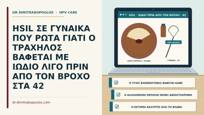 HSIL ΣΕ ΓΥΝΑΙΚΑ ΠΟΥ ΡΩΤΑ ΓΙΑΤΙ Ο ΤΡΑΧΗΛΟΣ ΒΑΦΕΤΑΙ ΜΕ ΙΩΔΙΟ ΛΙΓΟ ΠΡΙΝ ΑΠΟ ΤΟΝ ΒΡΟΧΟ ΣΤΑ 42 χρώση με ιώδιο πριν από την εκτομή με βρόχο