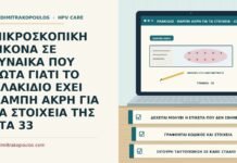 θαμπή άκρη πλακιδίου για ταυτοποίηση