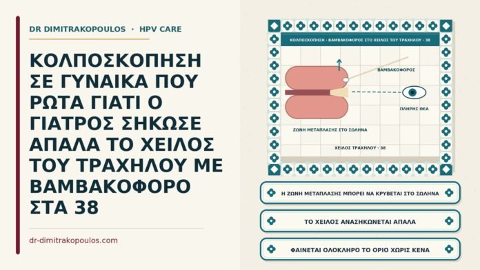ΚΟΛΠΟΣΚΟΠΗΣΗ ΣΕ ΓΥΝΑΙΚΑ ΠΟΥ ΡΩΤΑ ΓΙΑΤΙ Ο ΓΙΑΤΡΟΣ ΣΗΚΩΣΕ ΑΠΑΛΑ ΤΟ ΧΕΙΛΟΣ ΤΟΥ ΤΡΑΧΗΛΟΥ ΜΕ ΒΑΜΒΑΚΟΦΟΡΟ ΣΤΑ 38 βαμβακοφόρος στυλεός στο χείλος του τραχήλου