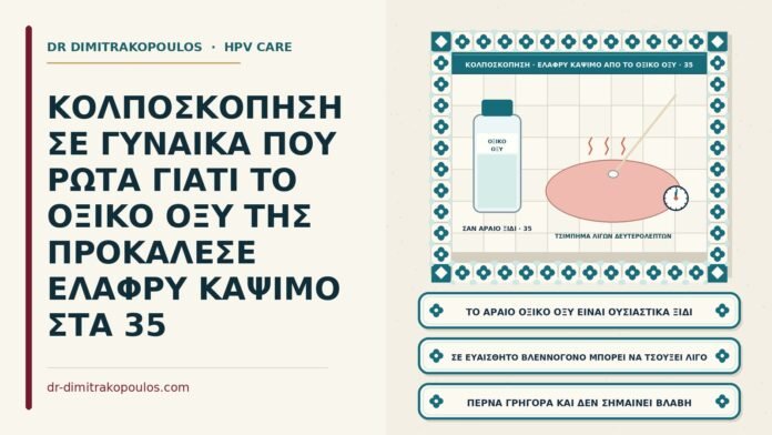 ελαφρύ κάψιμο από το οξικό οξύ