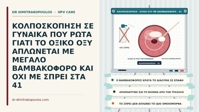ΚΟΛΠΟΣΚΟΠΗΣΗ ΣΕ ΓΥΝΑΙΚΑ ΠΟΥ ΡΩΤΑ ΓΙΑΤΙ ΤΟ ΟΞΙΚΟ ΟΞΥ ΑΠΛΩΝΕΤΑΙ ΜΕ ΜΕΓΑΛΟ ΒΑΜΒΑΚΟΦΟΡΟ ΚΑΙ ΟΧΙ ΜΕ ΣΠΡΕΙ ΣΤΑ 41 εφαρμογή οξικού οξέος με βαμβακοφόρο