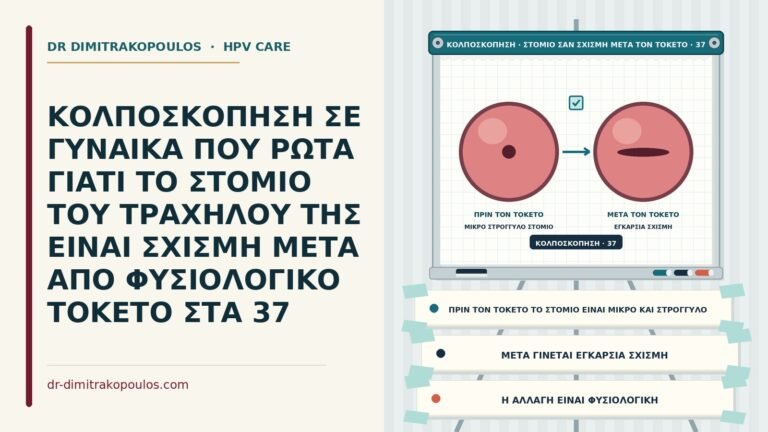 σχισμοειδές στόμιο μετά τον τοκετό