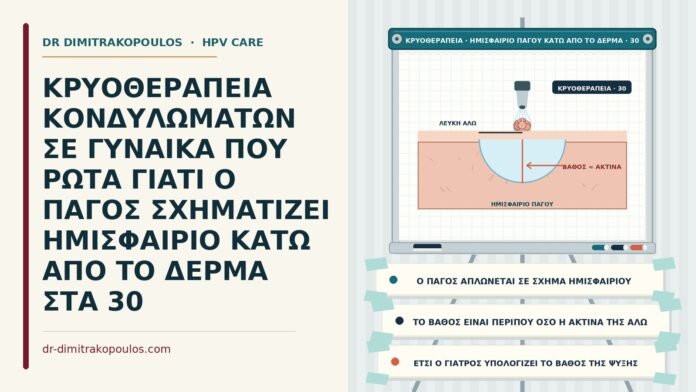 σχήμα του πάγου στην κρυοθεραπεία