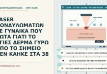 LASER ΚΟΝΔΥΛΩΜΑΤΩΝ ΣΕ ΓΥΝΑΙΚΑ ΠΟΥ ΡΩΤΑ ΓΙΑΤΙ ΤΟ ΥΓΙΕΣ ΔΕΡΜΑ ΓΥΡΩ ΑΠΟ ΤΟ ΣΗΜΕΙΟ ΔΕΝ ΚΑΗΚΕ ΣΤΑ 38 προστασία του υγιούς δέρματος στο laser
