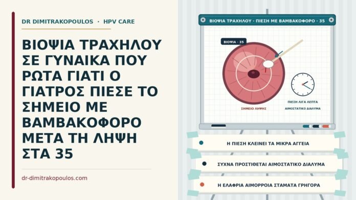 ΒΙΟΨΙΑ ΤΡΑΧΗΛΟΥ ΣΕ ΓΥΝΑΙΚΑ ΠΟΥ ΡΩΤΑ ΓΙΑΤΙ Ο ΓΙΑΤΡΟΣ ΠΙΕΣΕ ΤΟ ΣΗΜΕΙΟ ΜΕ ΒΑΜΒΑΚΟΦΟΡΟ ΜΕΤΑ ΤΗ ΛΗΨΗ ΣΤΑ 35 πίεση με βαμβακοφόρο μετά τη βιοψία