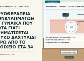 λευκό δαχτυλίδι πάγου στην κρυοθεραπεία