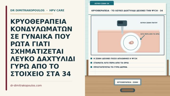 ΚΡΥΟΘΕΡΑΠΕΙΑ ΚΟΝΔΥΛΩΜΑΤΩΝ ΣΕ ΓΥΝΑΙΚΑ ΠΟΥ ΡΩΤΑ ΓΙΑΤΙ ΣΧΗΜΑΤΙΖΕΤΑΙ ΛΕΥΚΟ ΔΑΧΤΥΛΙΔΙ ΓΥΡΩ ΑΠΟ ΤΟ ΣΤΟΙΧΕΙΟ ΣΤΑ 34 λευκό δαχτυλίδι πάγου στην κρυοθεραπεία