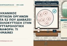 κοιλοκύττωση στην κυτταρολογική αναφορά