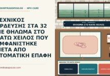 θήλωμα στο κάτω χείλος