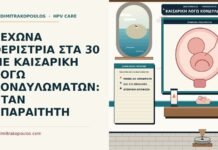 καισαρική λόγω κονδυλωμάτων