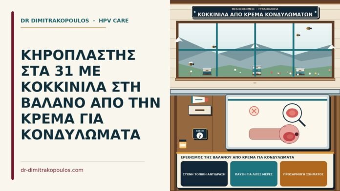 ΚΗΡΟΠΛΑΣΤΗΣ ΣΤΑ 31 ΜΕ ΚΟΚΚΙΝΙΛΑ ΣΤΗ ΒΑΛΑΝΟ ΑΠΟ ΤΗΝ ΚΡΕΜΑ ΓΙΑ ΚΟΝΔΥΛΩΜΑΤΑ ερεθισμός της βαλάνου από κρέμα για κονδυλώματα