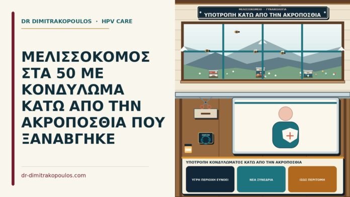 ΜΕΛΙΣΣΟΚΟΜΟΣ ΣΤΑ 50 ΜΕ ΚΟΝΔΥΛΩΜΑ ΚΑΤΩ ΑΠΟ ΤΗΝ ΑΚΡΟΠΟΣΘΙΑ ΠΟΥ ΞΑΝΑΒΓΗΚΕ υποτροπή κονδυλώματος κάτω από την ακροποσθία