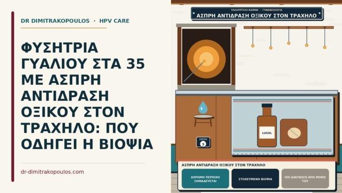 ΦΥΣΗΤΡΙΑ ΓΥΑΛΙΟΥ ΣΤΑ 35 ΜΕ ΑΣΠΡΗ ΑΝΤΙΔΡΑΣΗ ΟΞΙΚΟΥ ΣΤΟΝ ΤΡΑΧΗΛΟ: ΠΟΥ ΟΔΗΓΕΙ Η ΒΙΟΨΙΑ άσπρη αντίδραση οξικού στον τράχηλο