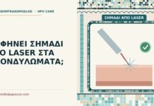 σημάδι από laser