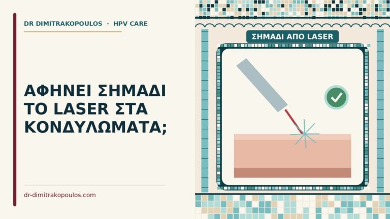 σημάδι από laser
