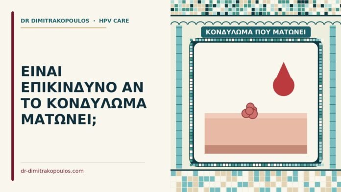 ΕΙΝΑΙ ΕΠΙΚΙΝΔΥΝΟ ΑΝ ΤΟ ΚΟΝΔΥΛΩΜΑ ΜΑΤΩΝΕΙ; κονδύλωμα που ματώνει