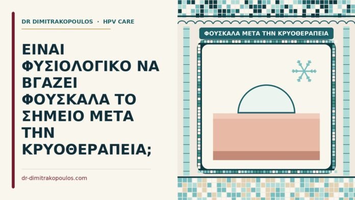 φουσκάλα μετά την κρυοθεραπεία