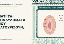 κνησμός από κονδυλώματα