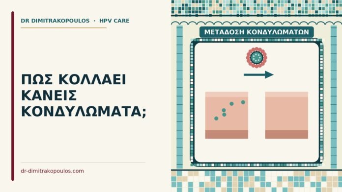 ΠΩΣ ΚΟΛΛΑΕΙ ΚΑΝΕΙΣ ΚΟΝΔΥΛΩΜΑΤΑ; μετάδοση κονδυλωμάτων