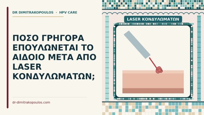 laser κονδυλωμάτων