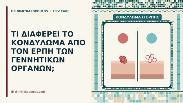 ΤΙ ΔΙΑΦΕΡΕΙ ΤΟ ΚΟΝΔΥΛΩΜΑ ΑΠΟ ΤΟΝ ΕΡΠΗ ΤΩΝ ΓΕΝΝΗΤΙΚΩΝ ΟΡΓΑΝΩΝ; κονδύλωμα ή έρπης