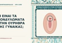 ΤΙ ΕΙΝΑΙ ΤΑ ΚΟΝΔΥΛΩΜΑΤΑ ΣΤΗΝ ΟΥΡΗΘΡΑ ΤΗΣ ΓΥΝΑΙΚΑΣ; κονδυλώματα στην ουρήθρα
