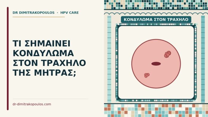 ΤΙ ΣΗΜΑΙΝΕΙ ΚΟΝΔΥΛΩΜΑ ΣΤΟΝ ΤΡΑΧΗΛΟ ΤΗΣ ΜΗΤΡΑΣ; κονδύλωμα στον τράχηλο
