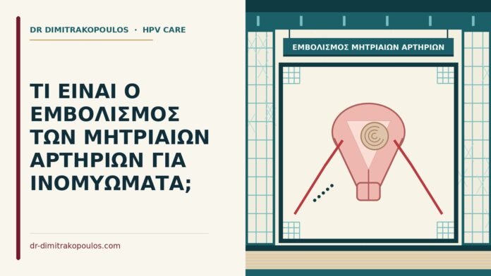 ΤΙ ΕΙΝΑΙ Ο ΕΜΒΟΛΙΣΜΟΣ ΤΩΝ ΜΗΤΡΙΑΙΩΝ ΑΡΤΗΡΙΩΝ ΓΙΑ ΙΝΟΜΥΩΜΑΤΑ; εμβολισμός μητριαίων αρτηριών