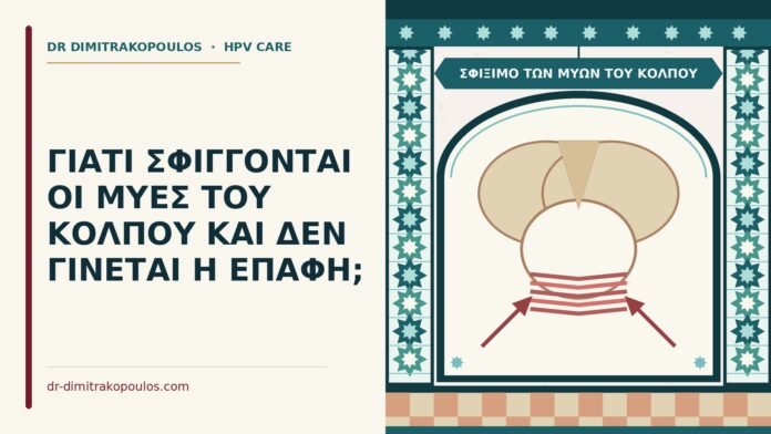 σφίξιμο των μυών του κόλπου
