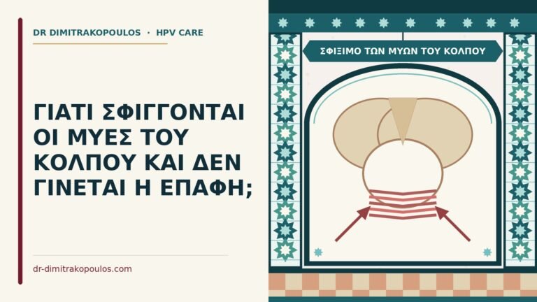 σφίξιμο των μυών του κόλπου