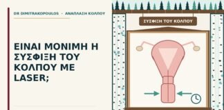 σύσφιξη του κόλπου