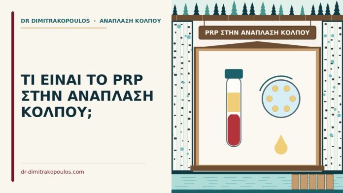 ΤΙ ΕΙΝΑΙ ΤΟ PRP ΣΤΗΝ ΑΝΑΠΛΑΣΗ ΚΟΛΠΟΥ; PRP στην ανάπλαση κόλπου