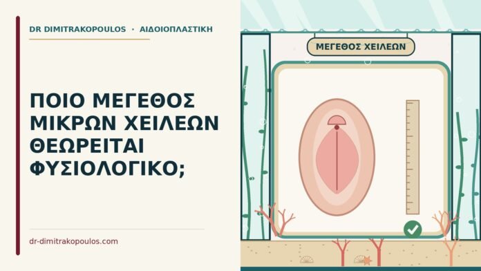 ΠΟΙΟ ΜΕΓΕΘΟΣ ΜΙΚΡΩΝ ΧΕΙΛΕΩΝ ΘΕΩΡΕΙΤΑΙ ΦΥΣΙΟΛΟΓΙΚΟ; μέγεθος των μικρών χειλέων
