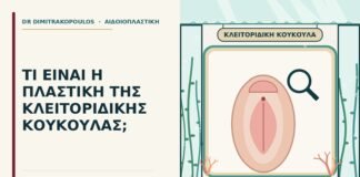 πλαστική της κλειτοριδικής κουκούλας