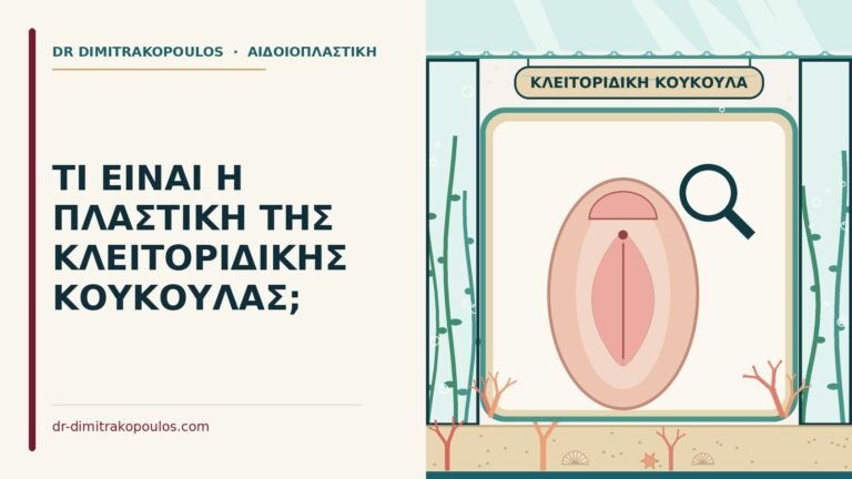 πλαστική της κλειτοριδικής κουκούλας